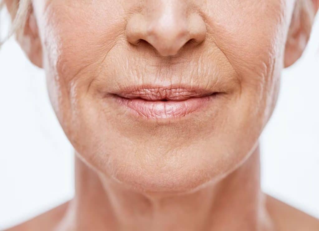 pérdida de colágeno después de la menopausia