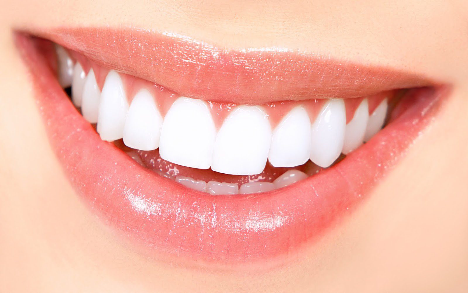 Los pro y los contra de las carillas dentales